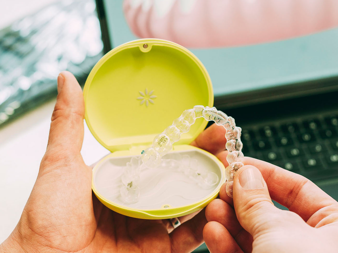 Abbildung einer transparenten Zahnspange in der Kieferorthopädie Ditzingen